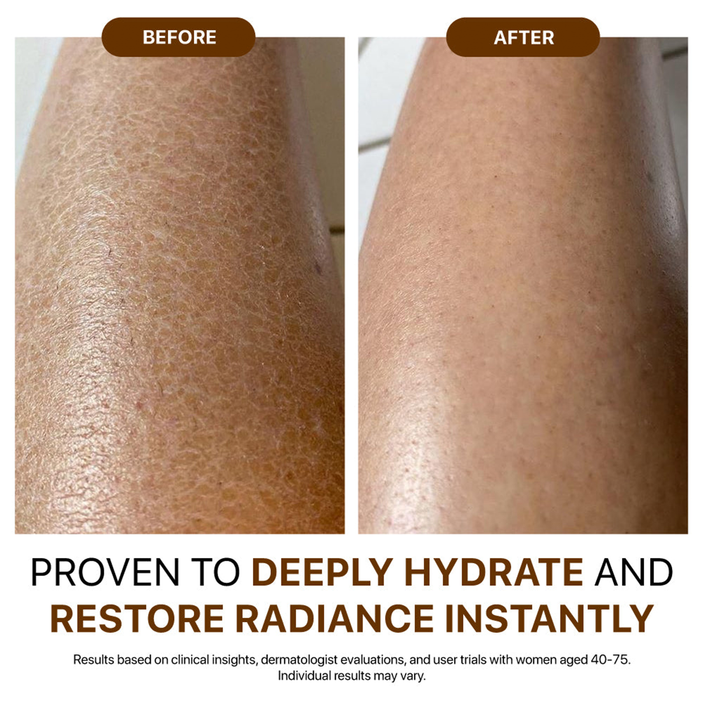 Before and after hydration result